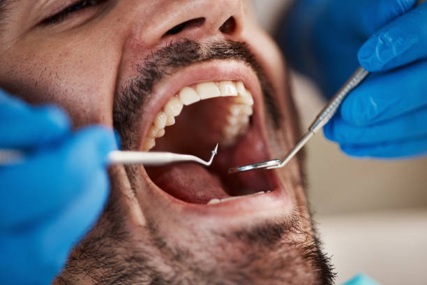 Best Emergency Dental Care for Broken or Chipped Teeth in Gordon, NE